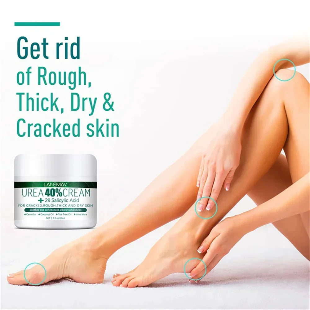 Herbal Anti-Crack Foot Cream - Heel Repair & Dead Skin Removal