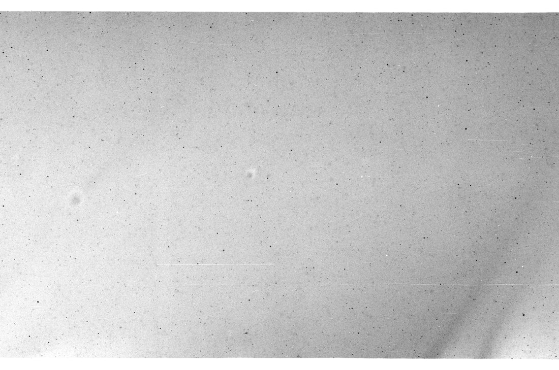 A black and white photo of a person's face