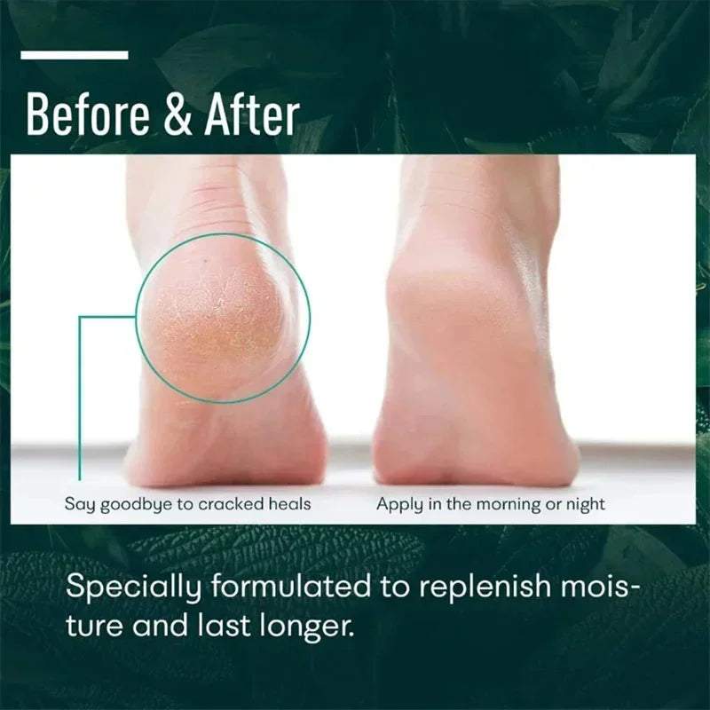Herbal Anti-Crack Foot Cream - Heel Repair & Dead Skin Removal