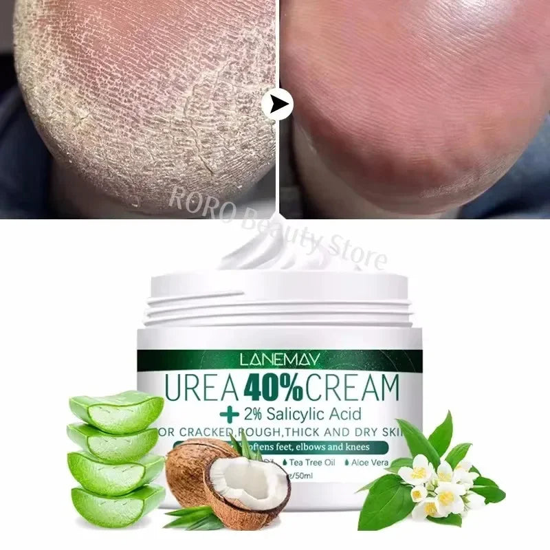 Herbal Anti-Crack Foot Cream - Heel Repair & Dead Skin Removal