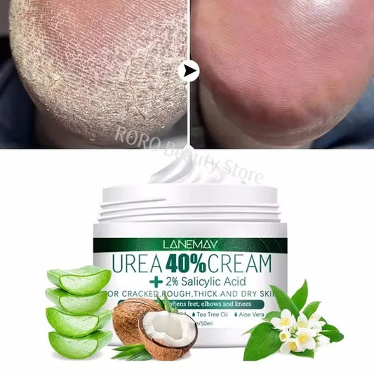 Herbal Anti-Crack Foot Cream - Heel Repair & Dead Skin Removal