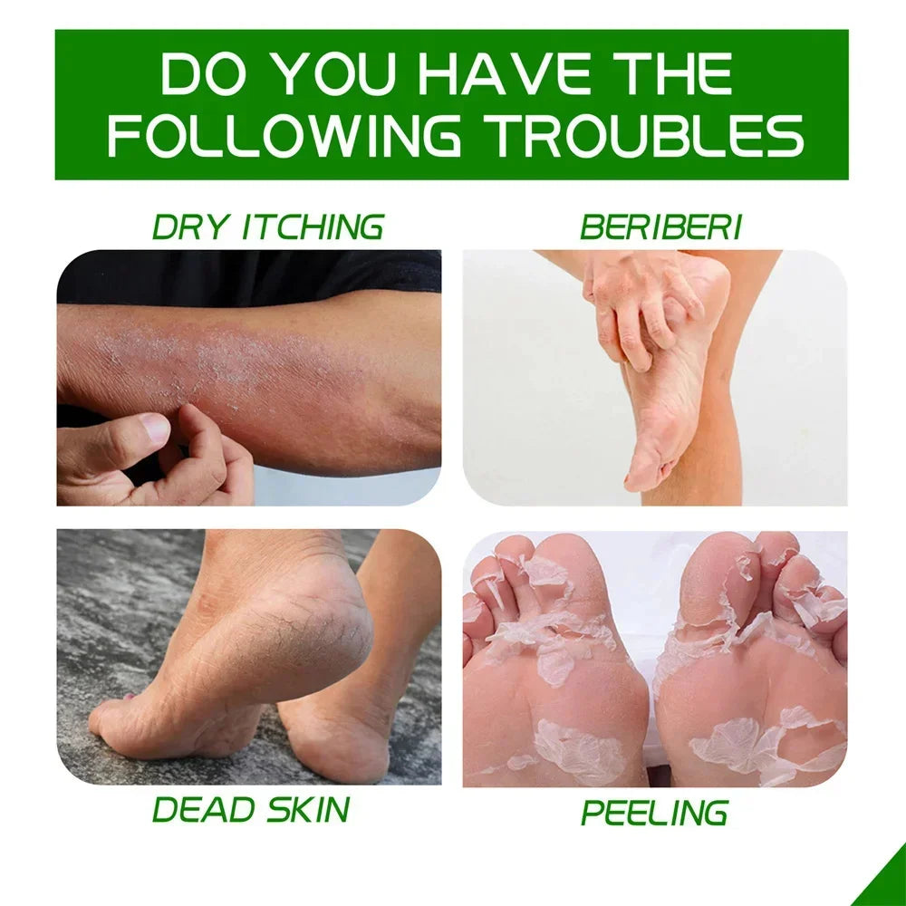 Herbal Anti-Crack Foot Cream - Heel Repair & Dead Skin Removal