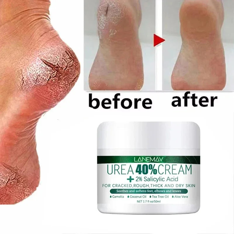 Herbal Anti-Crack Foot Cream - Heel Repair & Dead Skin Removal