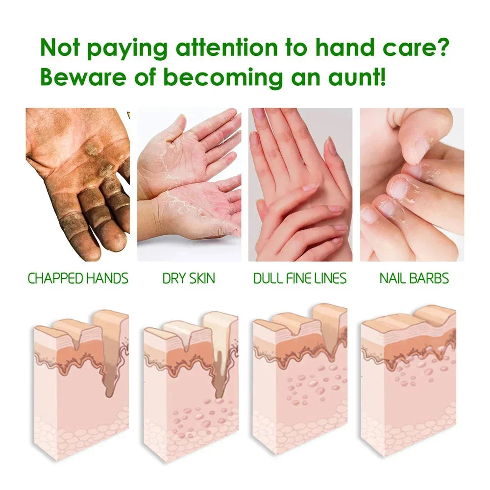 Herbal Anti-Crack Foot Cream - Heel Repair & Dead Skin Removal